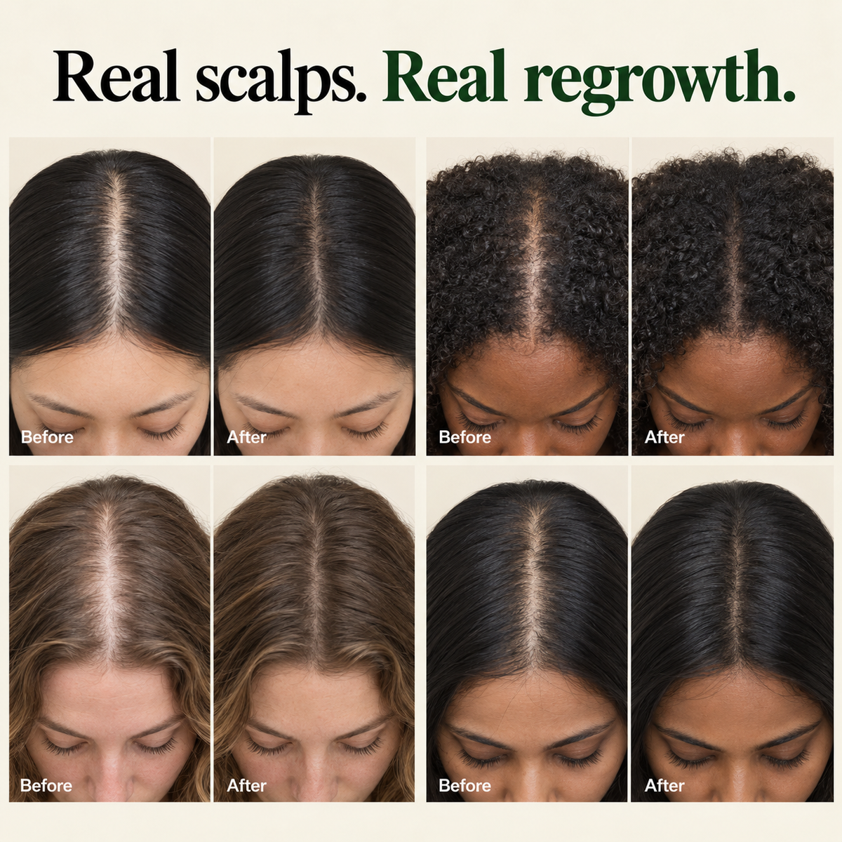 Korean Scalp Ritual Bar