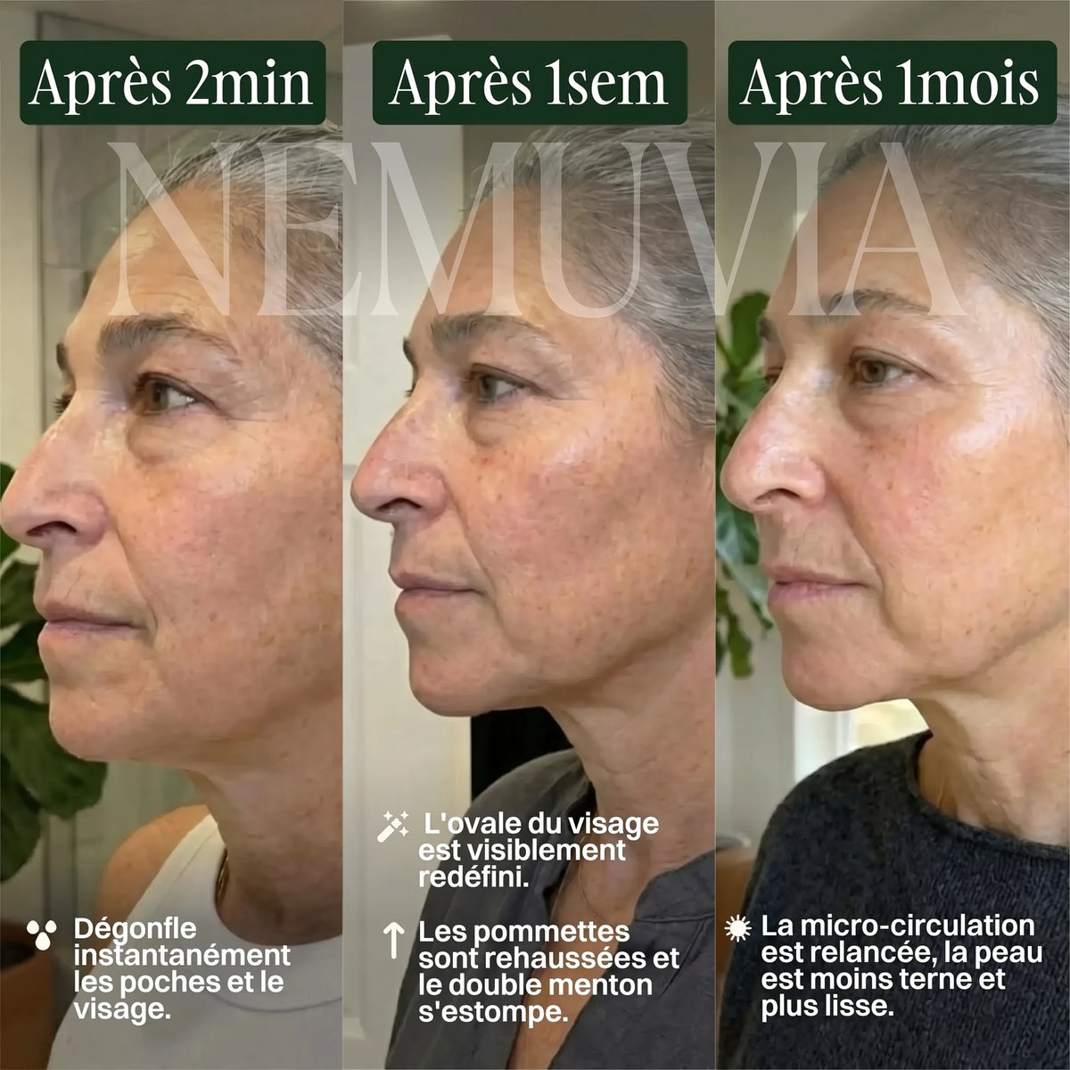 Resultats apres 2 min, 1 semaine, 1 mois